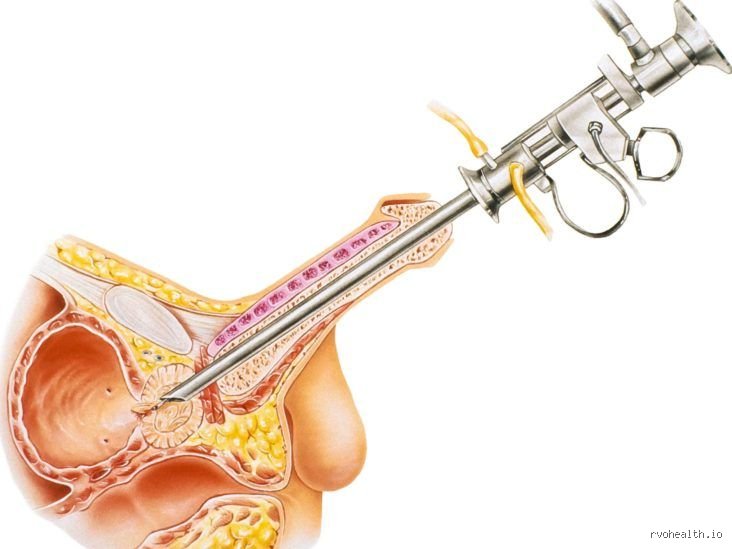Navigating life without a prostate: Survival, Adaptation, and biological realities