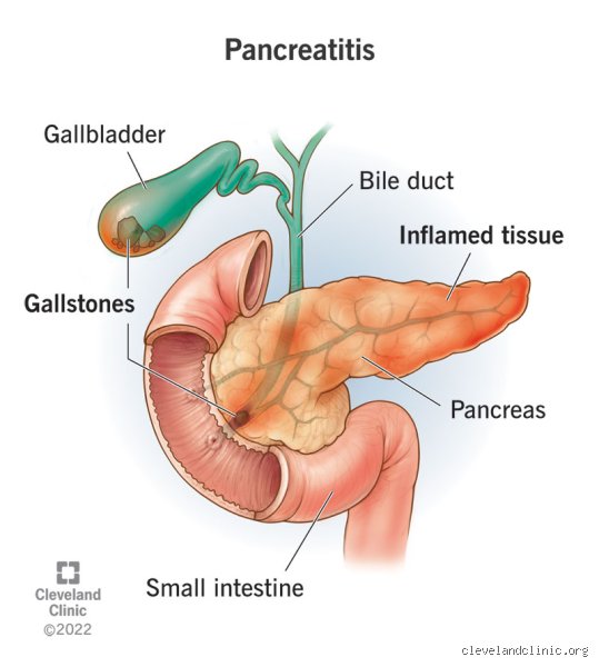 Can Your Pancreas Heal Itself From Pancreatitis? Separating Medical Myth From Cellular Reality