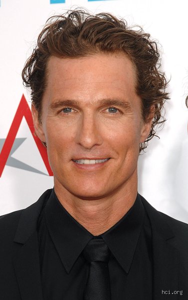 How Did Matthew McConaughey Get the Scars on His Face And The Wild Teen Story Behind Them