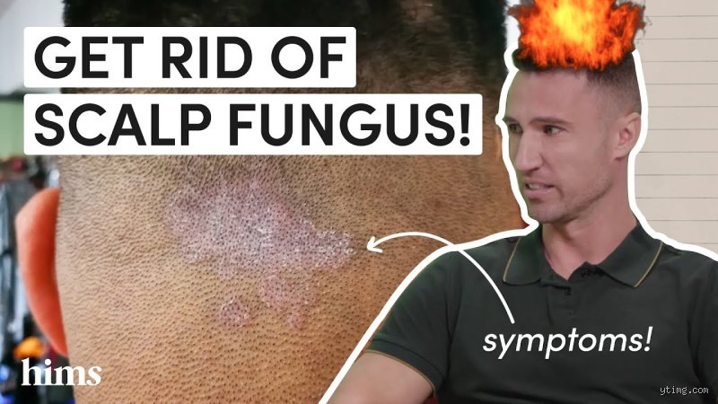 Why You Cannot Permanently Remove Fungus From Hair Without Rewriting Your Scalp’s Whole Ecosystem