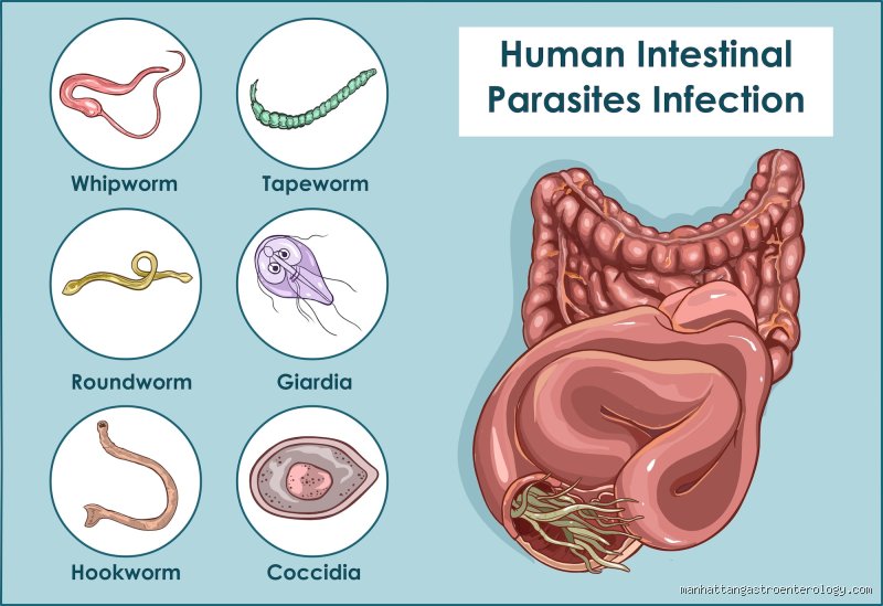 The Phantom Grumble: How Does Your Stomach Feel If You Have a Parasite?