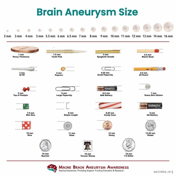 How Serious Is a 5mm Aneurysm? Evaluating the Hidden Risks, Rupture Rates, and Modern Clinical Realities