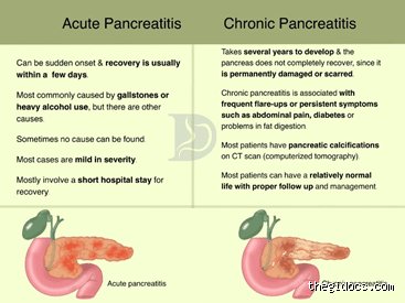 How to Tell if It’s Acute or Chronic Pancreatitis: The Critical Differences Medical Textbooks Often Skip