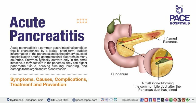 Is Acute Pancreatitis Considered a Critical Illness? The Reality Beyond the Insurance Policy Definition
