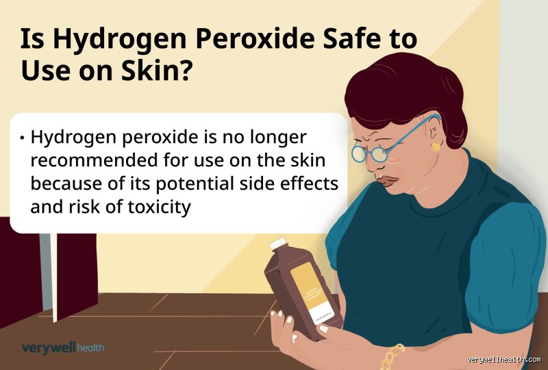 Is Hydrogen Peroxide Considered Toxic? The Truth Behind This Common Chemical