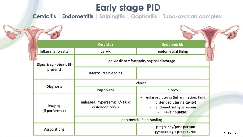 Decoding The Stages of Pelvic Inflammatory Disease Progression And Medical Staging