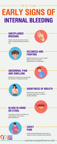 When the Clock Starts Ticking: Recognizing the Subtle and Brutal First Signs of Bleeding Out in Emergencies
