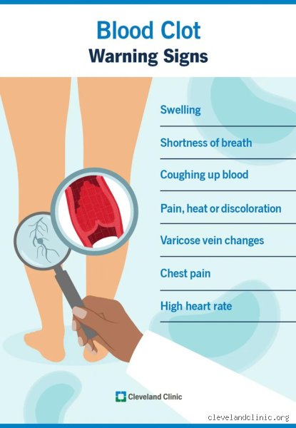 What Are the Five Warning Signs of a Blood Clot? The Silent Vascular Threat You Cannot Afford to Ignore