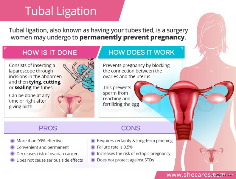 Decoding the Truth: What Are the Long Term Effects of Female Sterilization That No One Discusses?