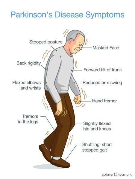 Unmasking the Shadow Symptoms: What Are the Strange Behaviors of Parkinson’s Patients and Why Do They Happen?