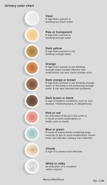 What Color Is Urine with Liver Disease? Recognizing the Warning Signs in Your Body's Waste