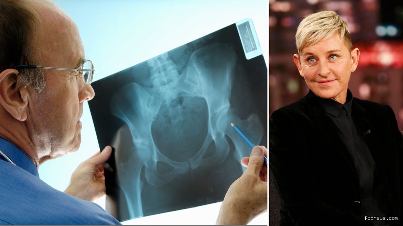 What diagnosis does Ellen DeGeneres have?