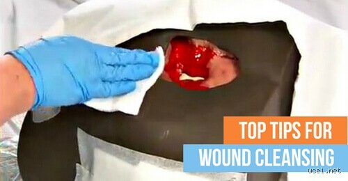Battle in the Operating Room: What Do Surgeons Use to Disinfect Wounds When Lives Are on the Line?