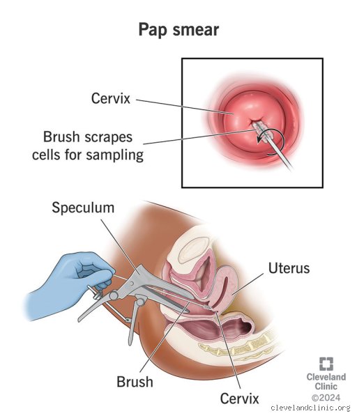 What happens if I never do a Pap smear? The unspoken realities of skipping cervical screening