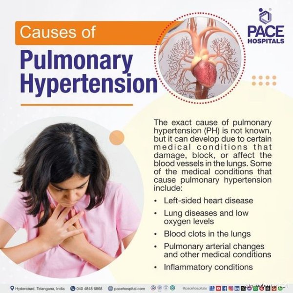 The Hidden Epidemic Inside Your Lungs: Discovering What Is the Number One Cause of Pulmonary Hypertension