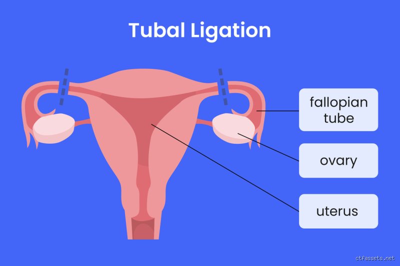 What to Expect During the Recovery After Sterilization: A No-Nonsense Guide to the Days Following Permanent Contraception