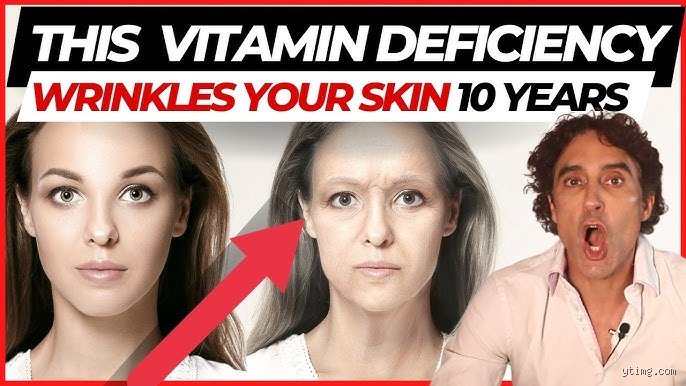 What Vitamin Deficiency Causes Face Wrinkles? The Truth About Micronutrients and Skin Aging
