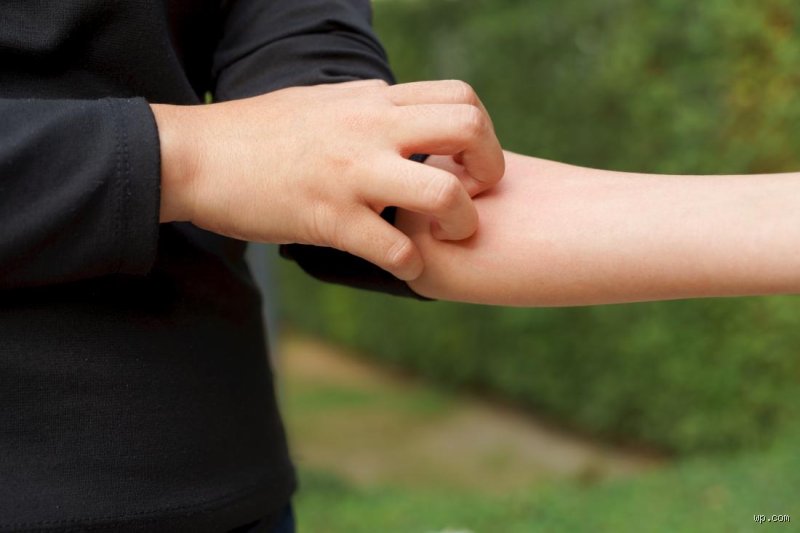 Scratching the Surface: Where Do You Itch the Most With Diabetes and How Your Skin Signals Trouble