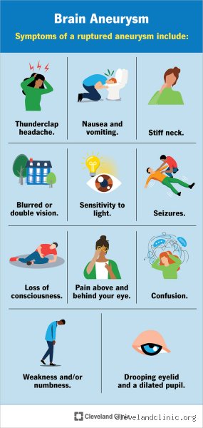 Where Would You Feel Pain If You Had a Brain Aneurysm? The Silent Threat and Its Real Warning Signs