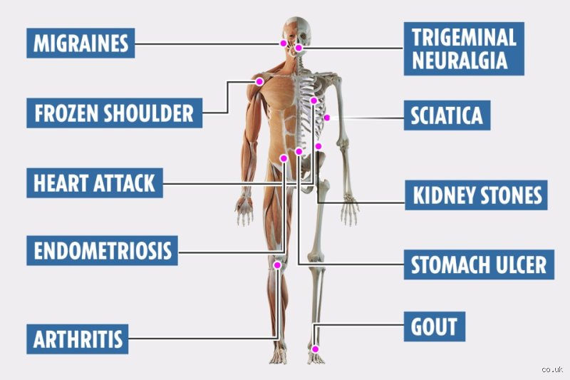Ranking Agony: Which Disease Gives the Most Pain According to Neurologists and Patients?
