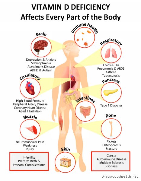 Beyond the Skeleton: Which Organ Is Affected by Vitamin D Deficiency and the Hidden Costs of the Modern Indoors
