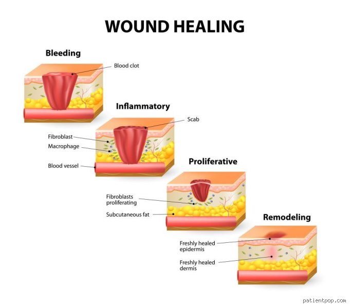 Beyond the Band-Aid: Which Vitamins Help Heal Wounds Faster and Rescue Damaged Skin?