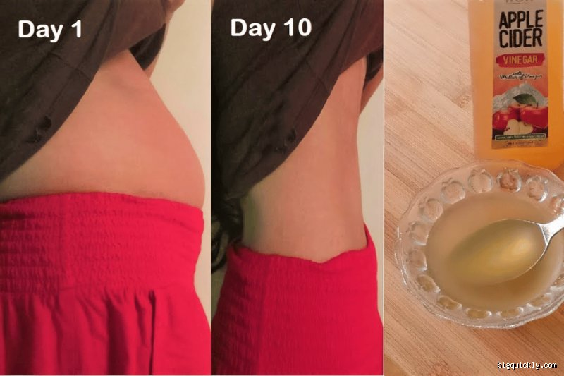 Will vinegar burn belly fat?