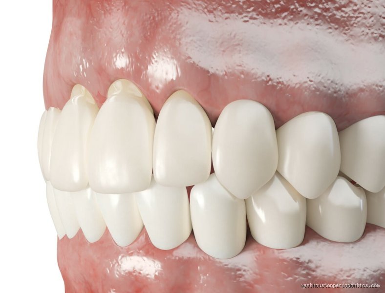 Do Gums Ever Grow Back After Receding? The Hard Truth and Modern Clinical Realities