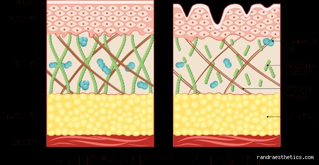 The Hidden Saboteurs: What Depletes Collagen in Skin and How Modern Life Accelerated the Decline