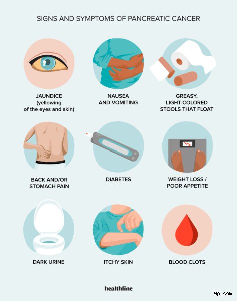 Whispers in the Abdomen: Decoding Three Overlooked Pancreatic Cancer Symptoms Before It Is Too Late