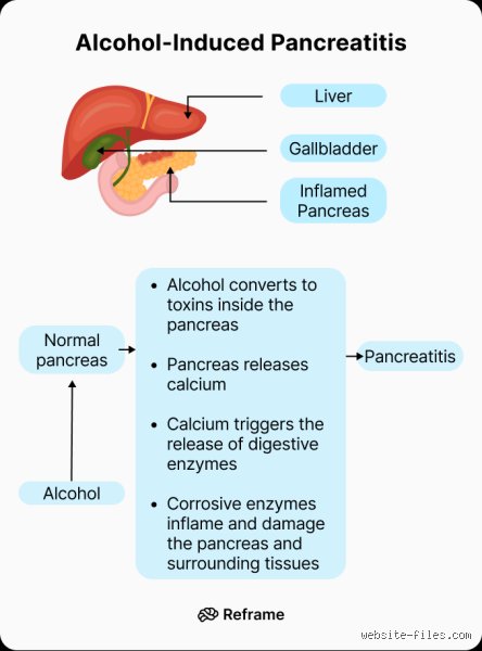What Alcohol Can You Drink With Pancreatitis? The Hard Truth Patients Need to Hear