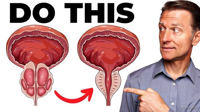 What Three Nuts Can Shrink a Swollen Prostate?