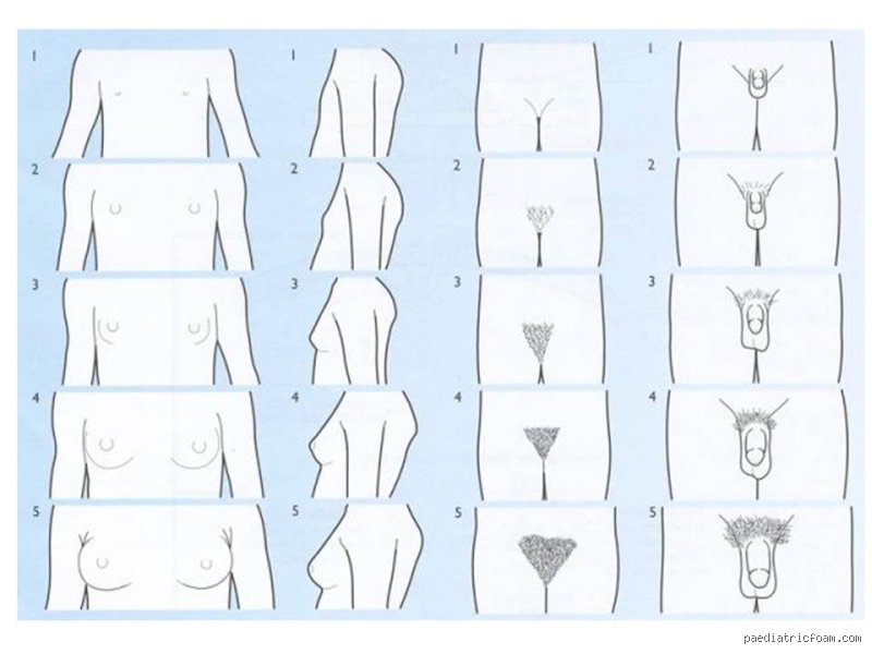 Is it normal for an 8 year old to have pubic hair?