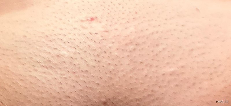 The No-Nonsense Guide on How Can a Girl Get a Smooth Shave Down There Without Irritation