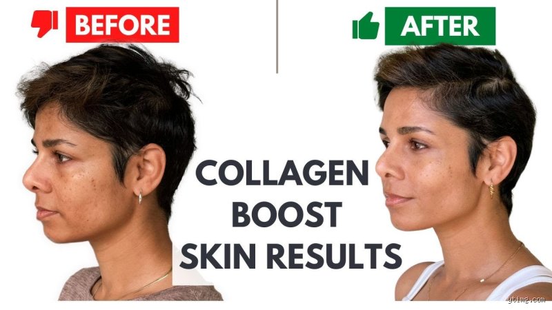 The Ageless Obsession: How Do I Restore Collagen in My Face Without Falling for Skincare Myths?