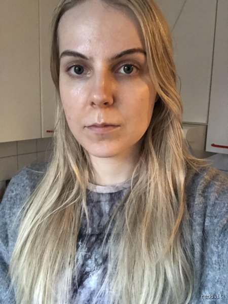 Why Do I Suddenly Look So Old And Tired Overnight According To Experts