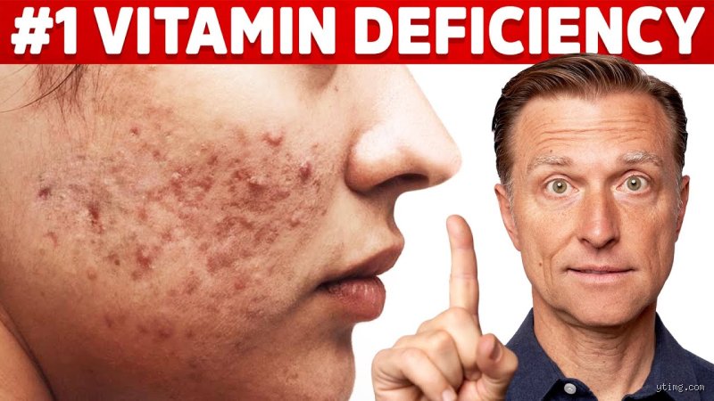 Can low vitamin D cause face breakouts?