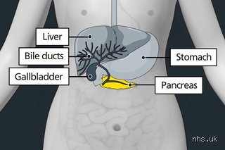 Can Pancreas Pain Feel Like a Pulled Muscle? An Expert Investigation