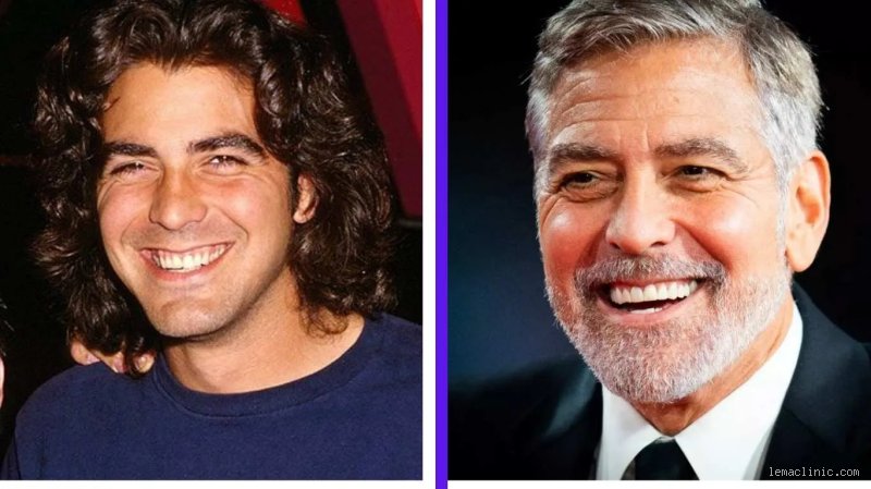 Does George Clooney wear dentures?
