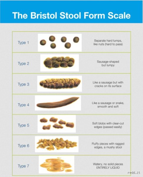 What color is poop with pancreatitis?