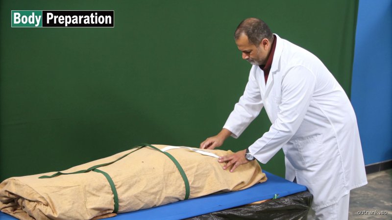 The Final Wardrobe: Do They Take the Clothes Off a Body Before Cremation?