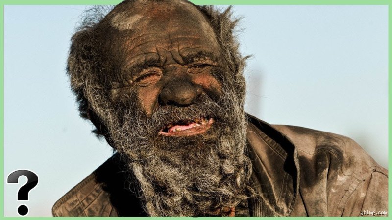 The Invisible Biofilm: What Happens If I Don't Shower In 4 Days and Why It Matters