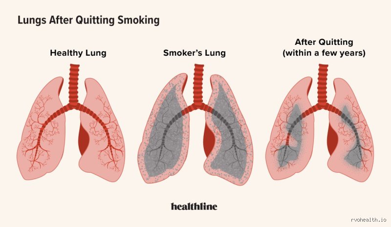 Can Lungs Heal After Being Damaged? The Surprising Truth About Pulmonary Regeneration and Irreversible Scars