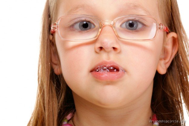 Beyond the Wet Bib: Do Autistic Toddlers Dribble More Than Neurotypical Children?