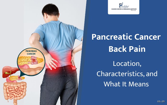 When Back Pain Fools You: Does Pancreatic Cancer Feel Like a Pulled Muscle?