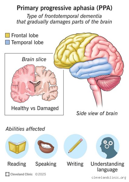 The Hidden Toll: Unmasking the Psychiatric and Cardiovascular Side Effects of PPA (Phenylpropanolamine)