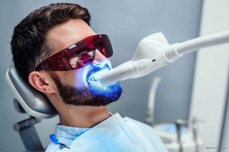 Beyond the Charcoal Fads: What Do Dentists Use to Whiten Teeth Safely and Effectively?
