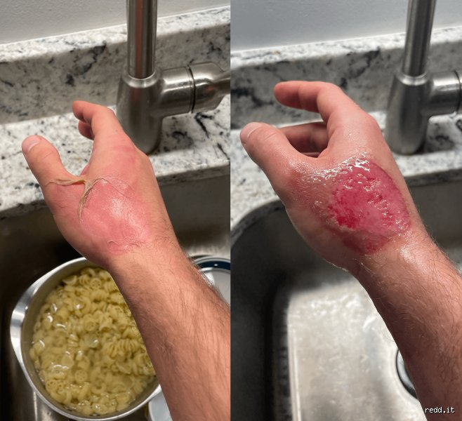 What happens if you boil water for 20 minutes?