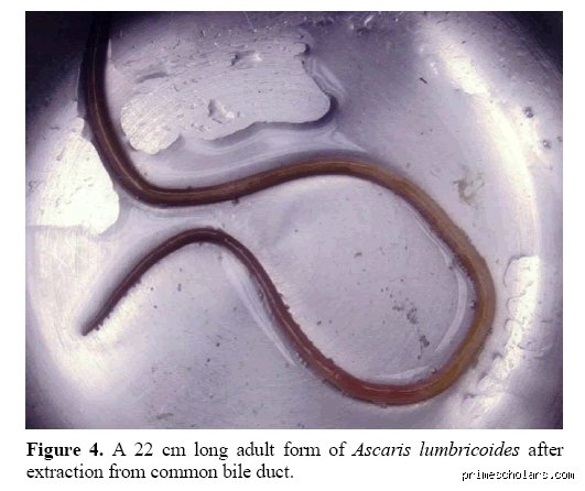 The Hidden Invader: What is the Parasite That Attacks the Pancreas and How Does It Evade Modern Medicine?
