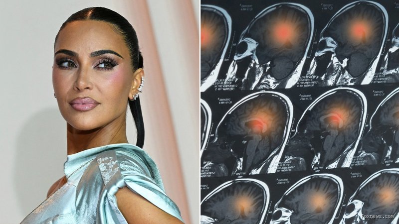 The Reality Behind the Headlines: When Did Kim Kardashian Have a Brain Aneurysm?